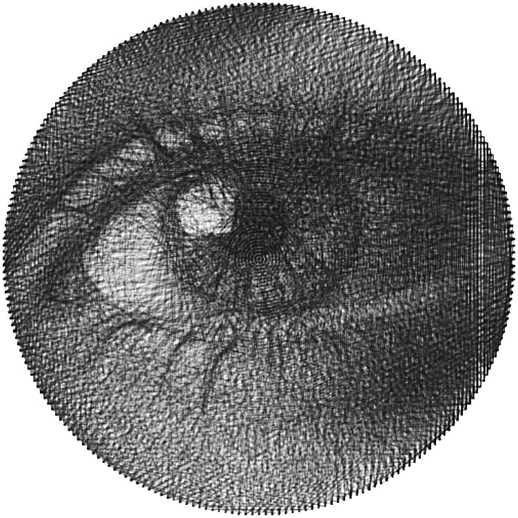 Eye